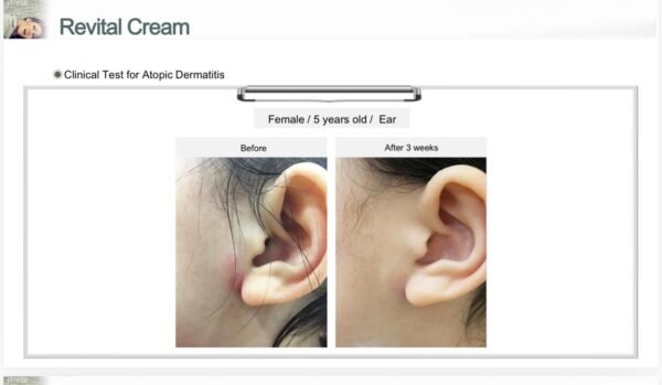 hihiiho EHAD revital cream (50g)