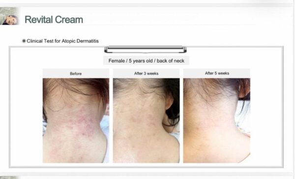 jkjk EHAD revital cream (50g)