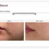 EHAD aczero serum (50g)