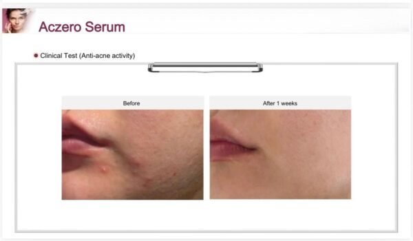 EHAD aczero serum (50g)