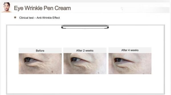 EHAD eye wrinkle pen cream 20g. (2x10g)