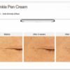 EHAD eye wrinkle pen cream 20g. (2x10g)