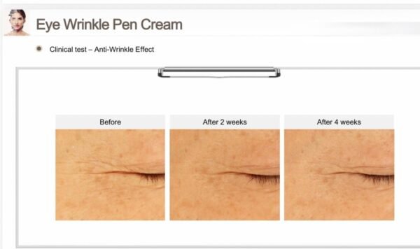 EHAD eye wrinkle pen cream 20g. (2x10g)