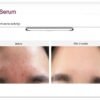 EHAD aczero serum (50g)