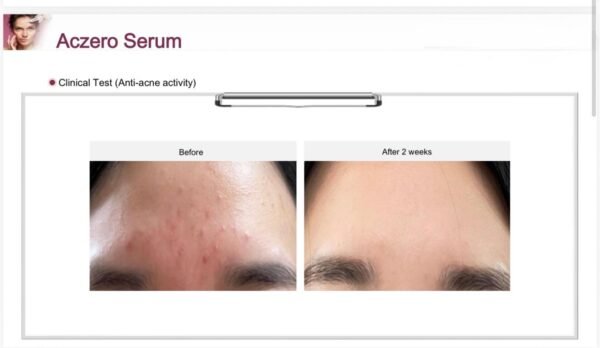 EHAD aczero serum (50g)