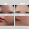 EHAD aczero serum (50g)